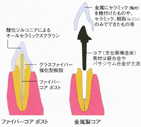 ファイバーコア